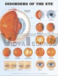 Disorders of the Eye Anatomical Chart, 2nd Edition